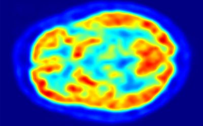 Fisiología de la hipnosis